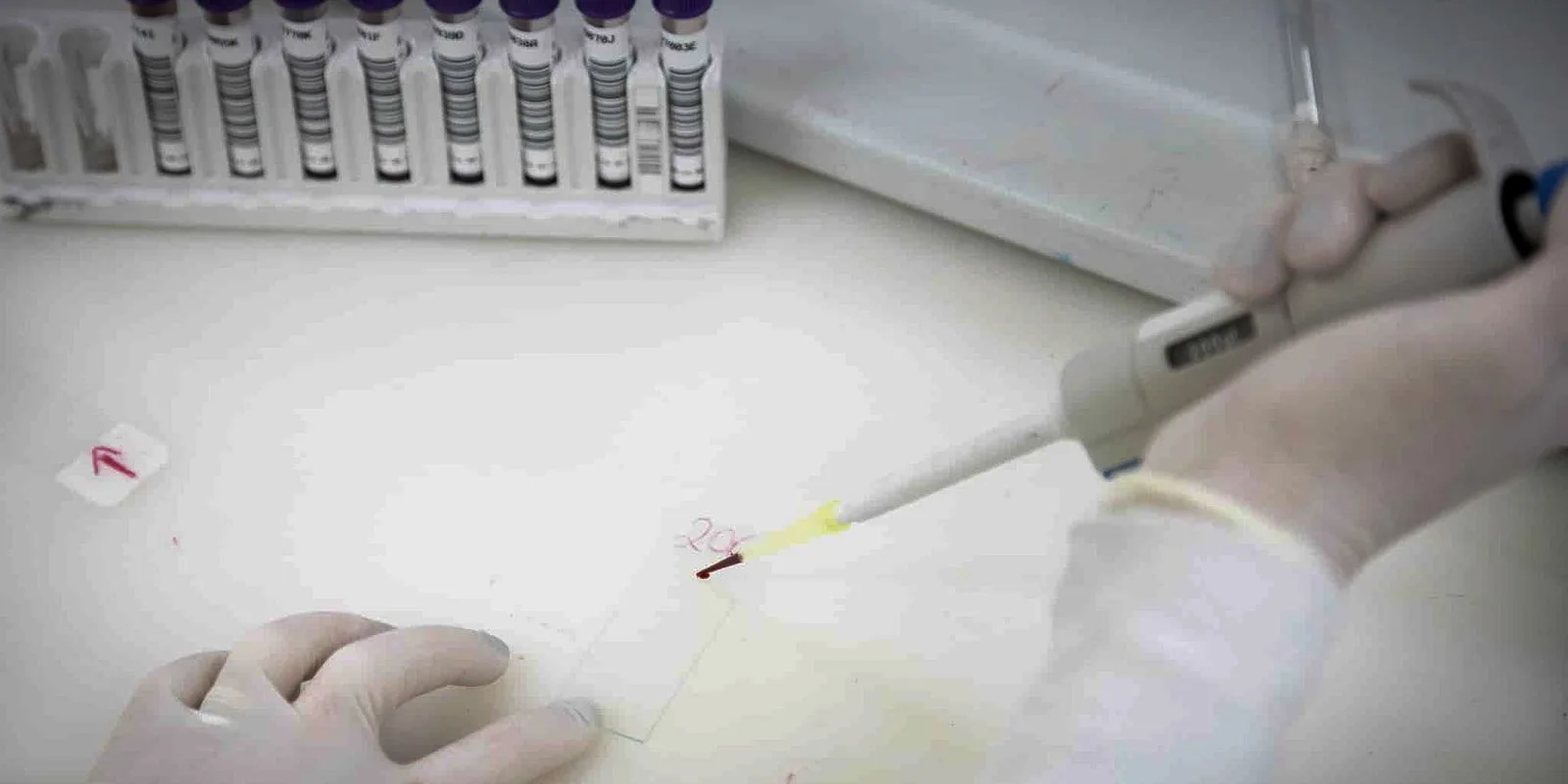 Secretaria de Saúde de SP investiga novo caso suspeito de ebola